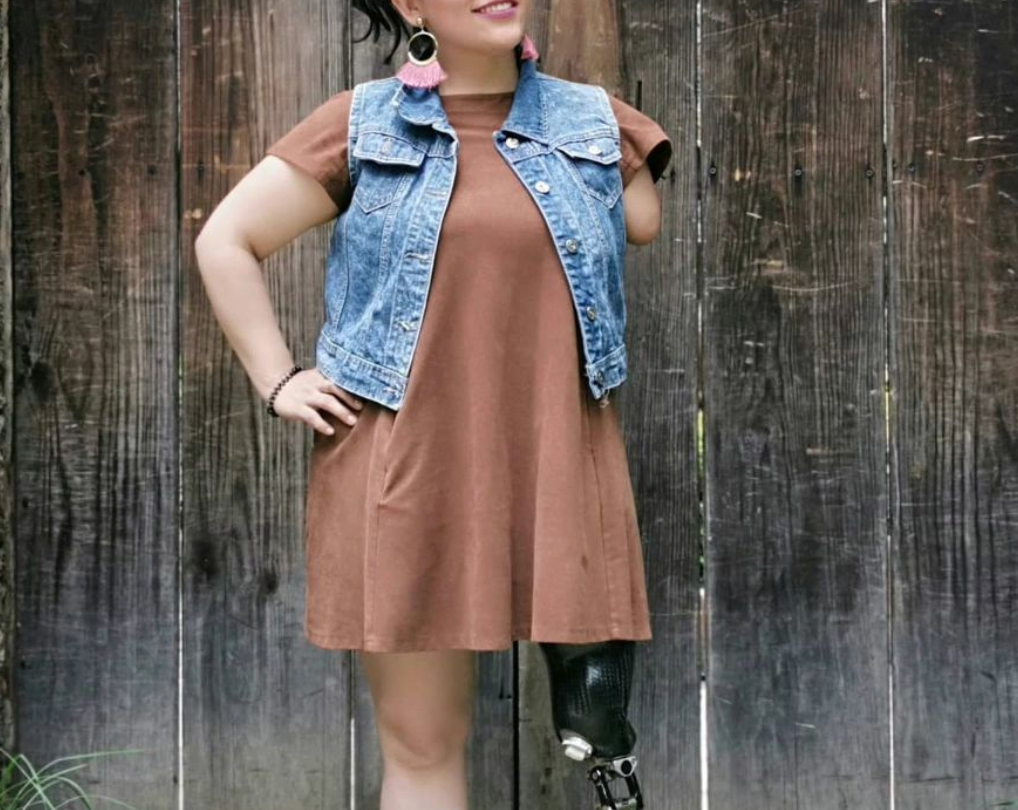 Mujer de pie con prótesis de pierna, sonriendo con actitud positiva